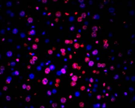 TUNEL LiFluor 594 Apoptosis Detection Kit